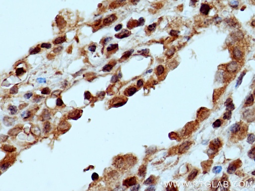 [12621-1-AP-20UL] PPP2R1B Polyclonal antibody