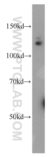 [12624-1-AP-150UL] RBBP8 Polyclonal antibody