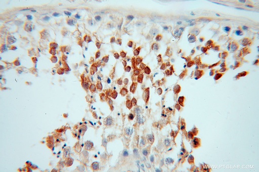 [12625-2-AP-150UL] PABPC3 Polyclonal antibody
