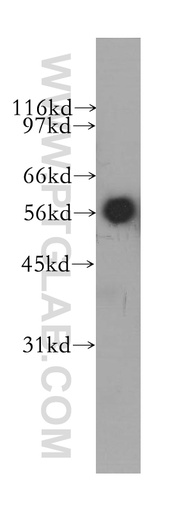 [12626-1-AP-150UL] CYB5R4 Polyclonal antibody