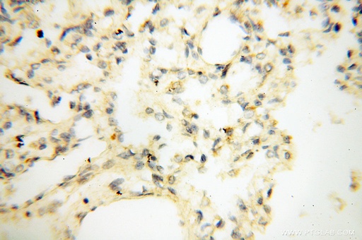 [12632-1-AP-150UL] LAMP3 Polyclonal antibody