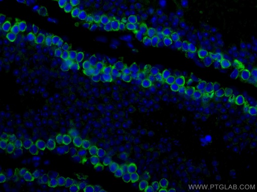 [12633-1-AP-150UL] DAZL Polyclonal antibody