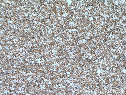 [12635-1-AP-150UL] GNAO1 Polyclonal antibody