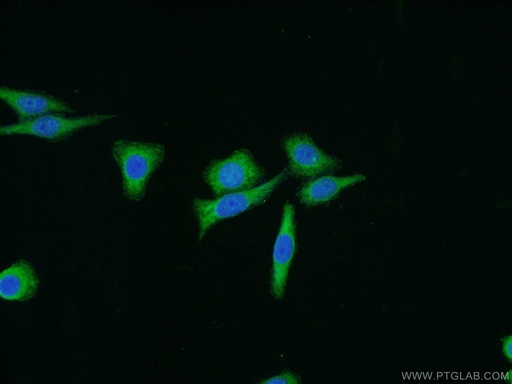 [12636-1-AP-20UL] FAK Polyclonal antibody