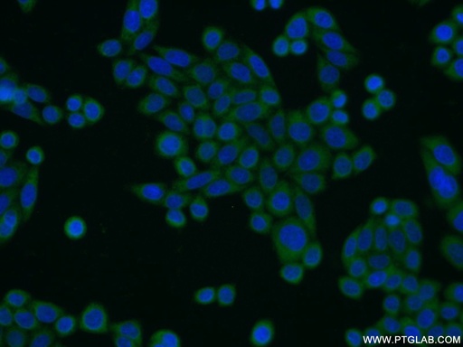 [12638-1-AP-20UL] CIAPIN1 Polyclonal antibody
