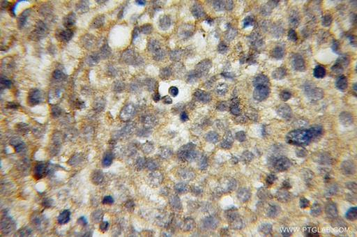 [12639-1-AP-150UL] APPL1 Polyclonal antibody