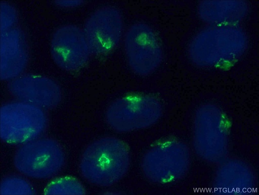 [12640-1-AP-150UL] golgin 97 Polyclonal antibody