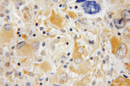[12642-1-AP-20UL] Synaptotagmin-4 Polyclonal antibody