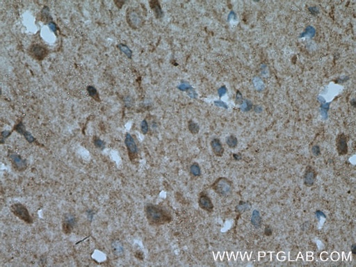[12643-1-AP-20UL] ENPP6 Polyclonal antibody