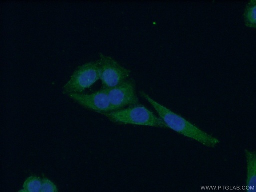 [12644-1-AP-20UL] WDR16 Polyclonal antibody