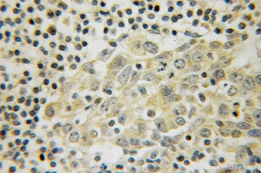 [12647-1-AP-150UL] LANCL1 Polyclonal antibody