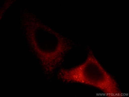 [12649-1-AP-150UL] TCIRG1 Polyclonal antibody