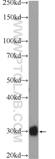 [12650-2-AP-20UL] FHL5 Polyclonal antibody