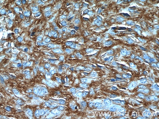 [12652-1-AP-150UL] TMEM16A/DOG1 Polyclonal antibody