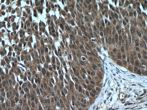 [12653-1-AP-150UL] ARMC8 Polyclonal antibody