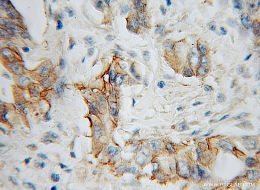 [12655-1-AP-150UL] IL-5RA Polyclonal antibody