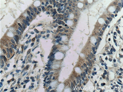 [12657-1-AP-20UL] Kir7.1 Polyclonal antibody