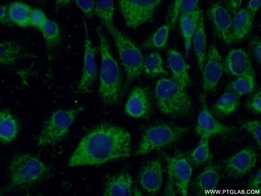 [12658-1-AP-20UL] P4HA1 Polyclonal antibody
