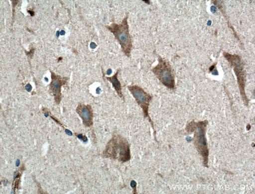 [12659-1-AP-20UL] GPR155 Polyclonal antibody
