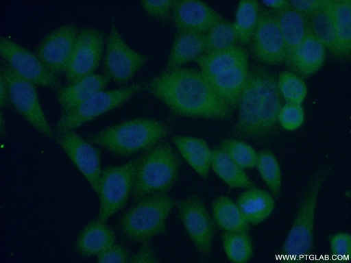 [12660-1-AP-150UL] IkB Beta Polyclonal antibody