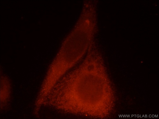 [12666-2-AP-150UL] CaMKII Gamma Polyclonal antibody