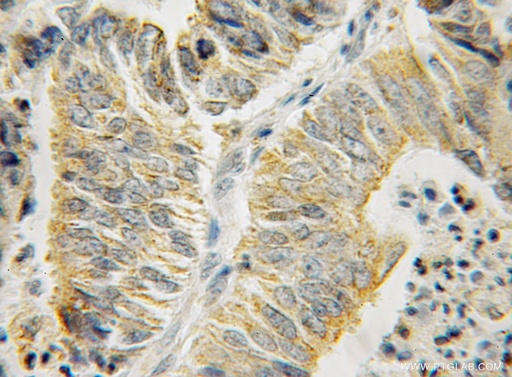[12667-2-AP-150UL] HSPA13 Polyclonal antibody