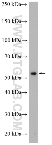 [12668-1-AP-150UL] TULP2 Polyclonal antibody