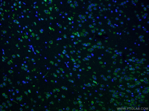 [12669-1-AP-150UL] CPEB3 Polyclonal antibody