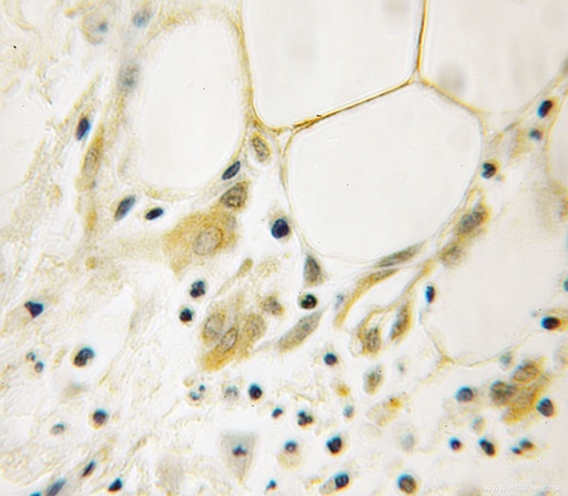 [12670-1-AP-150UL] AGFG1 Polyclonal antibody