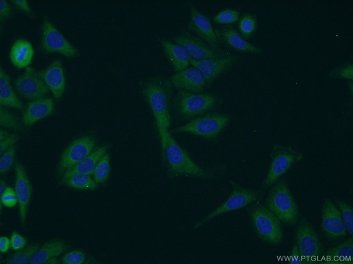 [12671-1-AP-150UL] RHPN2 Polyclonal antibody