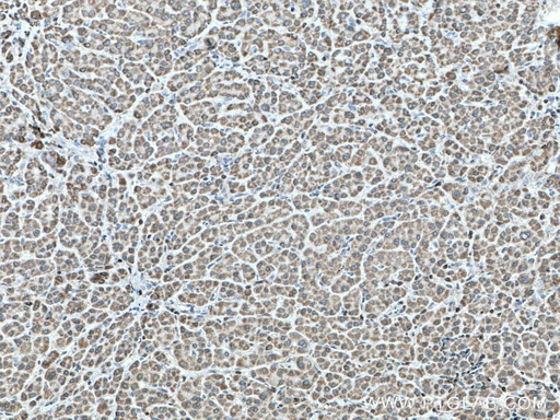 [12672-1-AP-150UL] SHCBP1 Polyclonal antibody