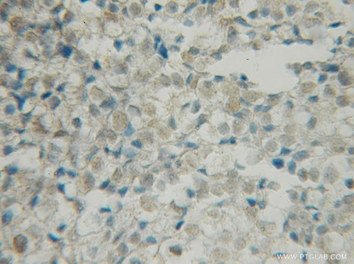 [12673-1-AP-150UL] BRSK1 Polyclonal antibody