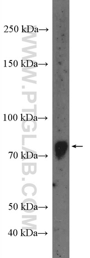 [12678-1-AP-150UL] GLIS3 Polyclonal antibody