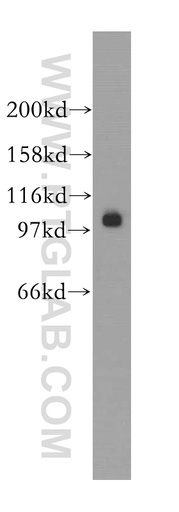 [12679-1-AP-150UL] SALL2 Polyclonal antibody