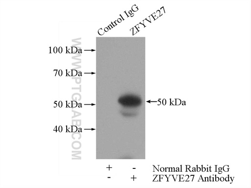 [12680-1-AP-150UL] ZFYVE27 Polyclonal antibody