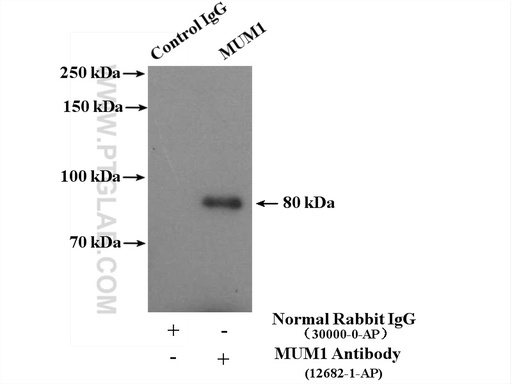 [12682-1-AP-20UL] MUM1 Polyclonal antibody