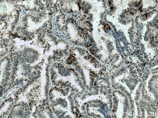 [12683-1-AP-150UL] MAD2L2 Polyclonal antibody
