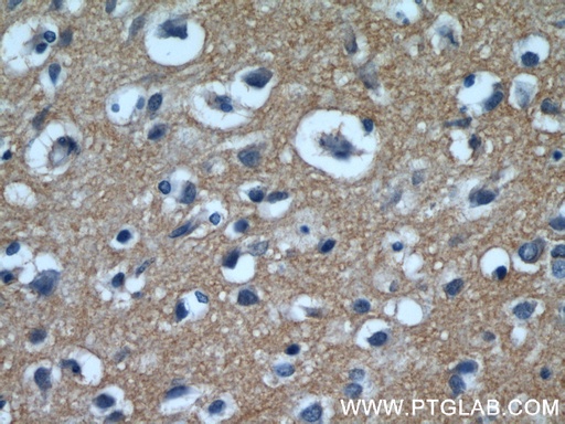 [12686-1-AP-20UL] EAAT3 Polyclonal antibody