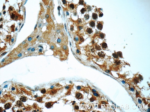[12693-1-AP-150UL] MNS1 Polyclonal antibody