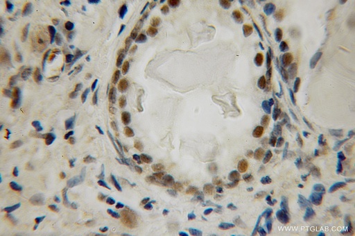 [12695-1-AP-20UL] LIG4 Polyclonal antibody