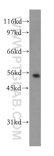 [12696-1-AP-20UL] Kir5.1 Polyclonal antibody