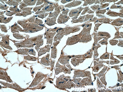[12697-1-AP-150UL] STK38L Polyclonal antibody