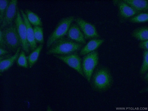 [12700-1-AP-150UL] KIFAP3 Polyclonal antibody