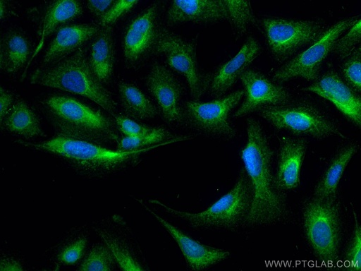 [12702-1-AP-20UL] BMPR1A Polyclonal antibody