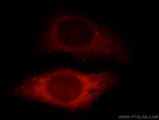 [12703-1-AP-150UL] SHKBP1 Polyclonal antibody