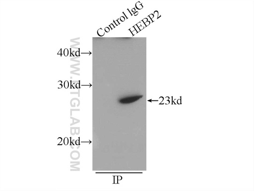 [12706-1-AP-150UL] HEBP2 Polyclonal antibody