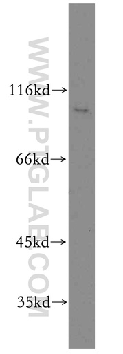 [12709-1-AP-20UL] RIN3 Polyclonal antibody