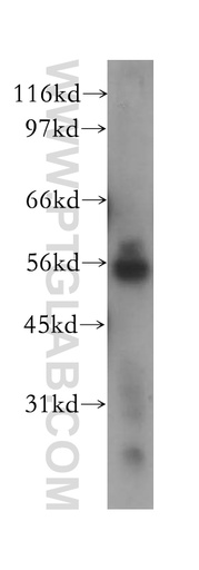 [12710-1-AP-150UL] NEK11 Polyclonal antibody