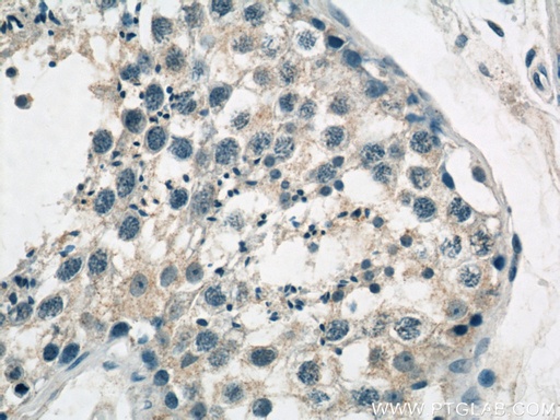[12712-1-AP-20UL] GCNF Polyclonal antibody