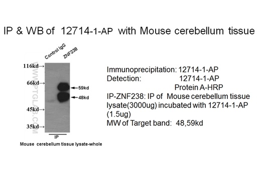 [12714-1-AP-150UL] ZNF238 Polyclonal antibody